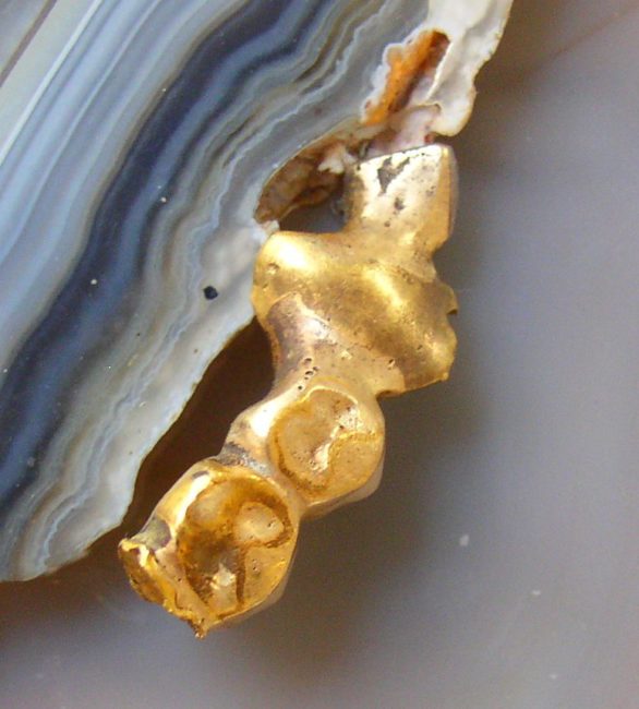 Dental Gold 1