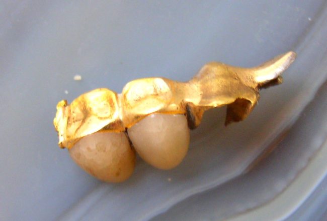 Dental Gold 2